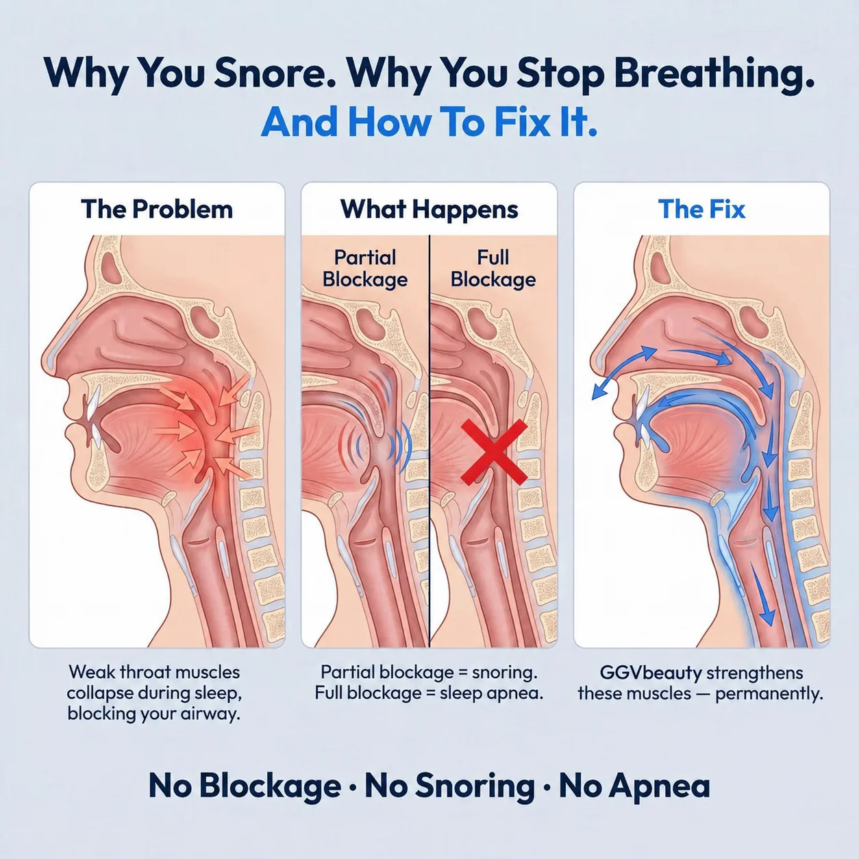 Professional Anti-Snoring Device-Eliminates Snoring & Sleep Apnea