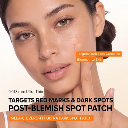 Zero-Fit Blemish & Dark Spot Patch Duo (144 Patches)