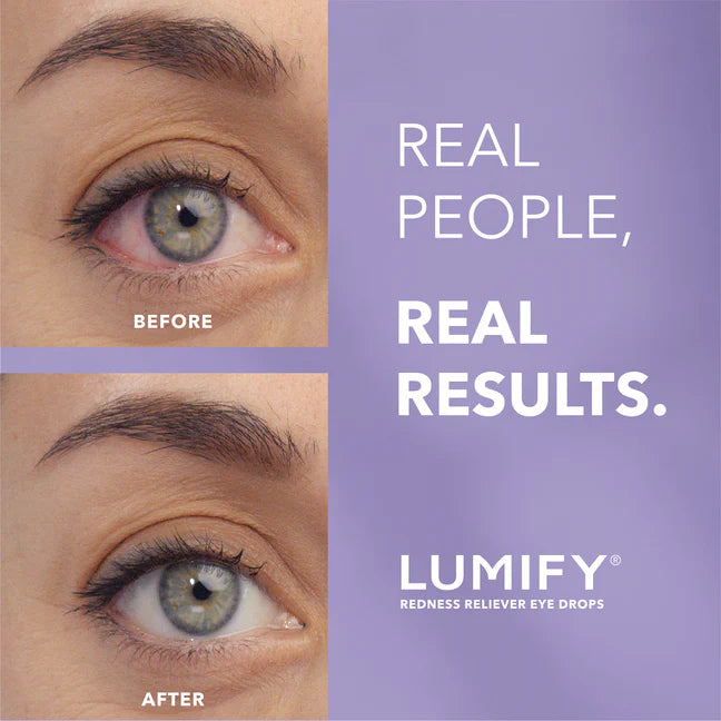 Redness Reliever Eye Drops-Works in 1 Minute & Lasts Up to 8 Hours