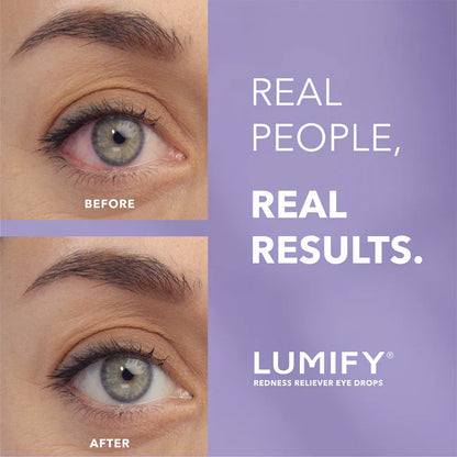 Redness Reliever Eye Drops-Works in 1 Minute & Lasts Up to 8 Hours