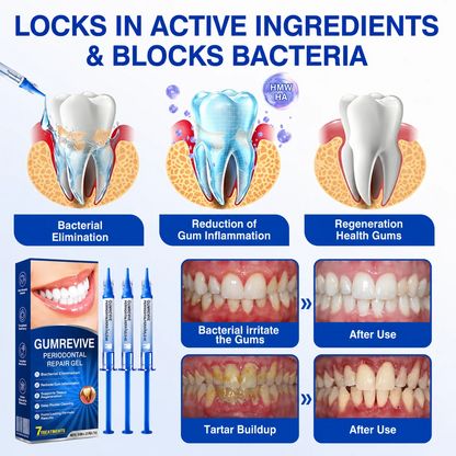 Periodontal Repair Gel