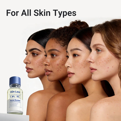 Drying Lotion Acne Spot Treatment – 1.8% Salicylic Acid