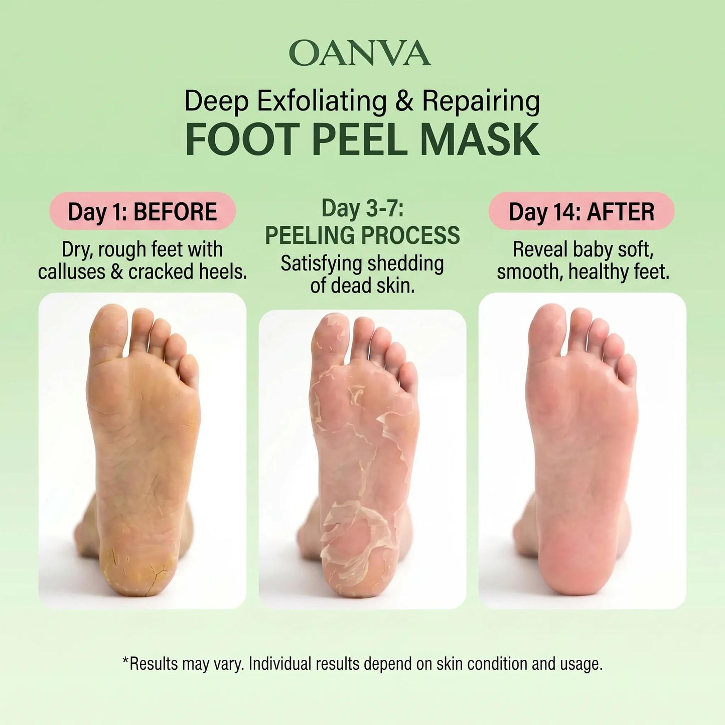 3-Piece Foot Peel Mask-Deep Exfoliating & Repairing
