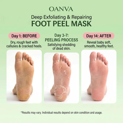 3-Piece Foot Peel Mask-Deep Exfoliating & Repairing