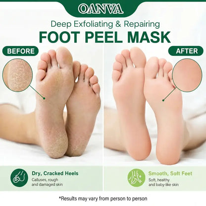 3-Piece Foot Peel Mask-Deep Exfoliating & Repairing