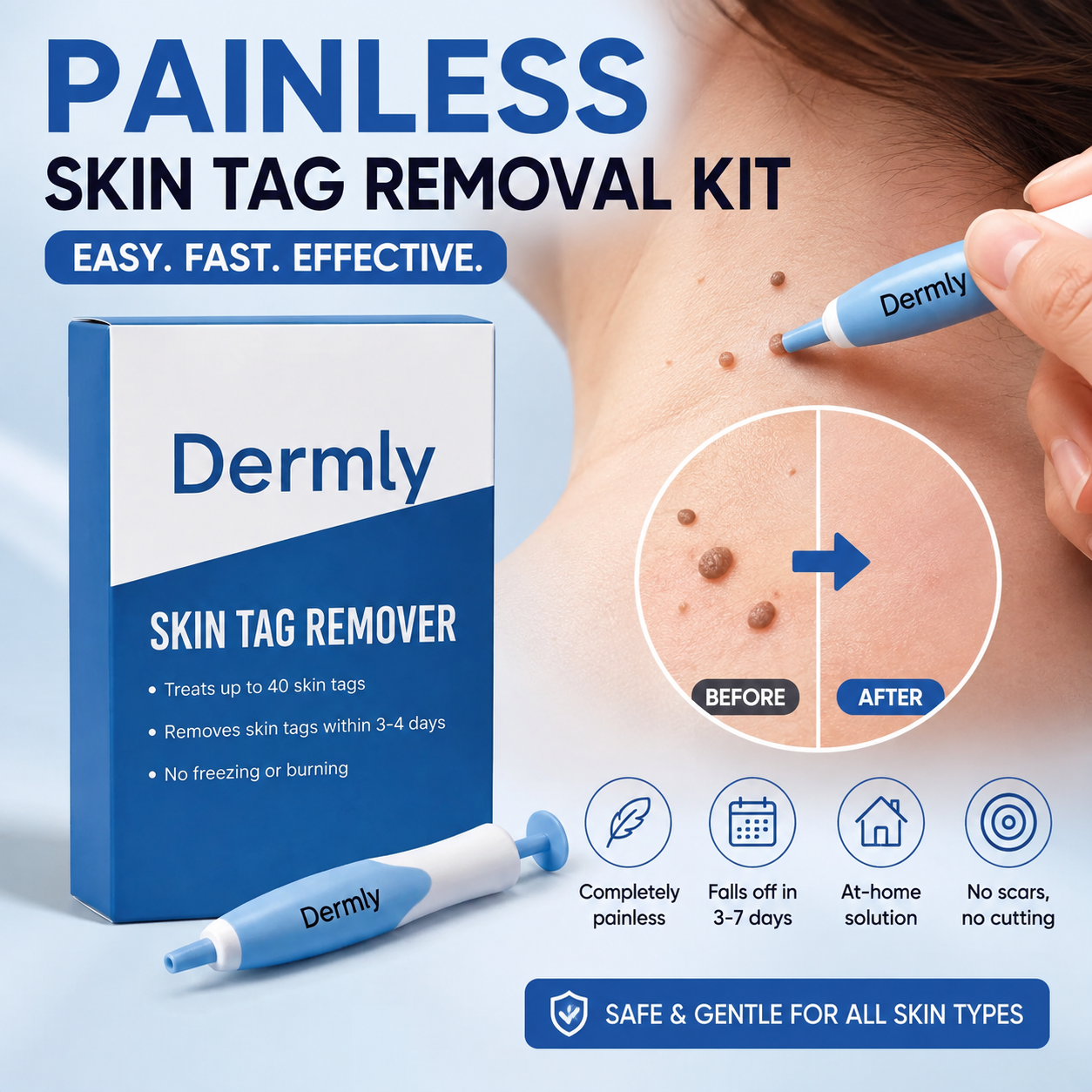 Painless Skin Tag Removal Kit - Safely Remove Skin Tags at Home