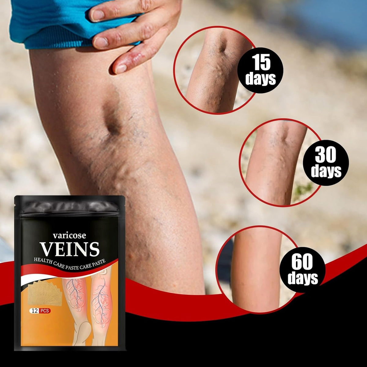 Buy 1 Get 1 Free 🔥 Varicose Vein Relief Patches
