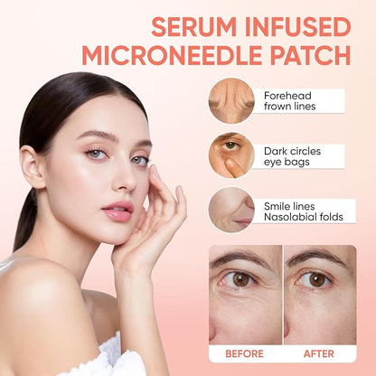 Micro-Needle Under-Eye Patches – Retinol, Collagen & Hydration