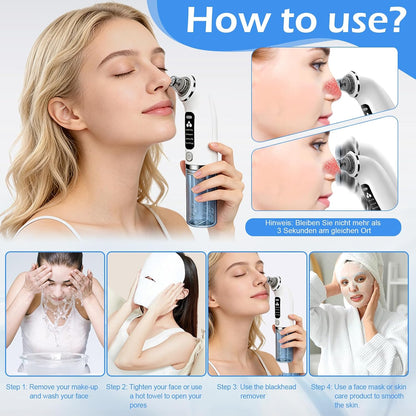 Blackhead Remover Pore Vacuum with 4 Suction Modes & 6 Tips