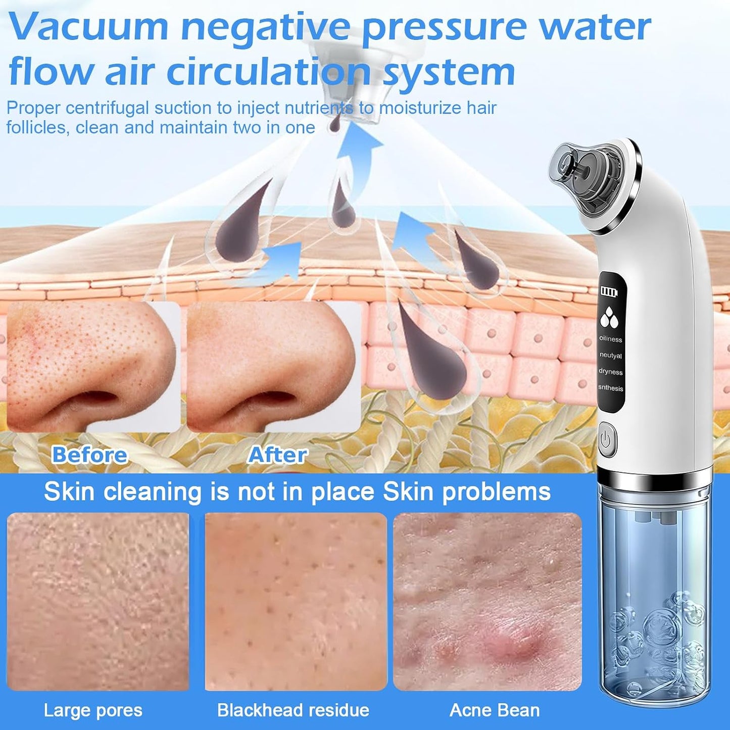 Blackhead Remover Pore Vacuum with 4 Suction Modes & 6 Tips