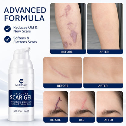 100% Silicone Scar Removal Gel
