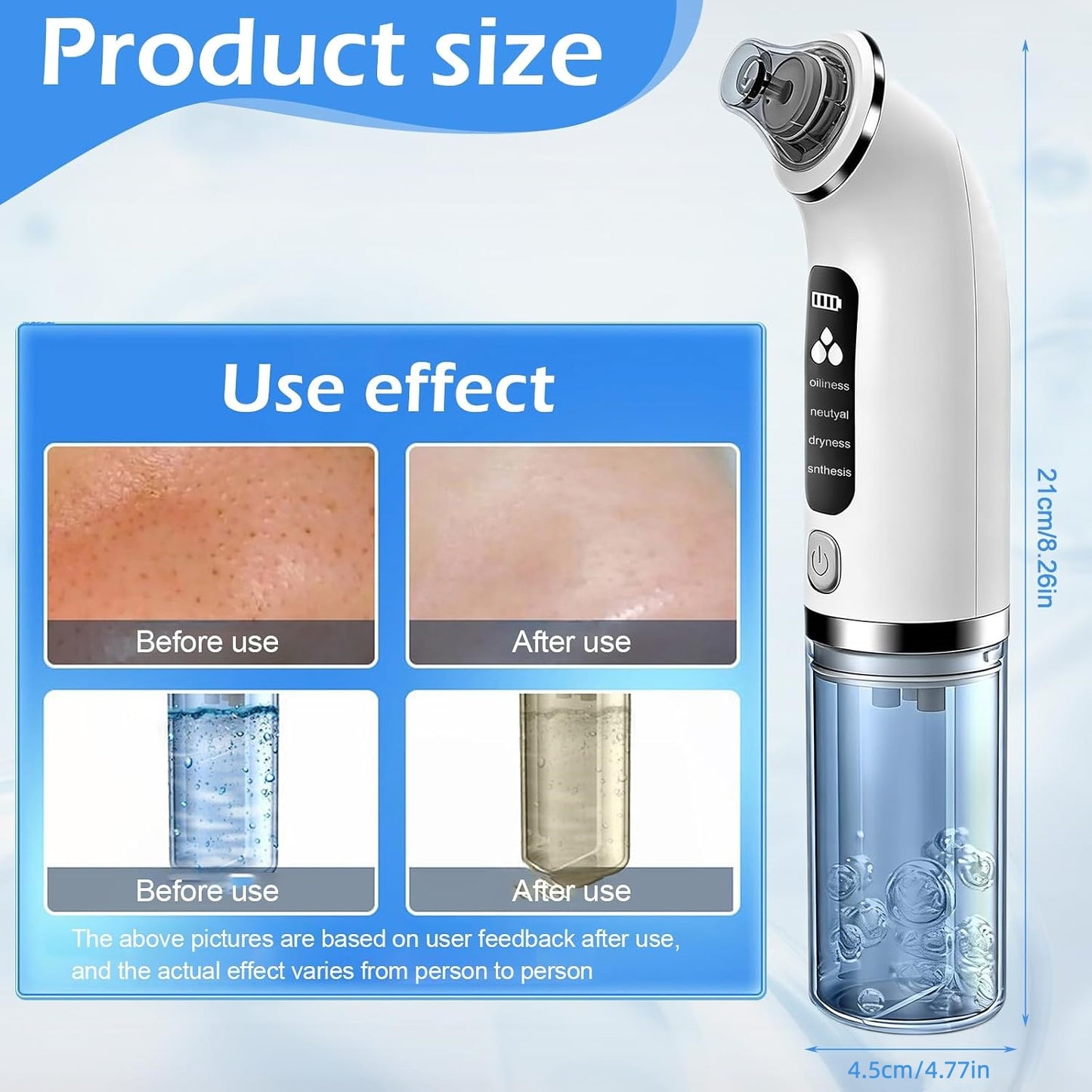 Blackhead Remover Pore Vacuum with 4 Suction Modes & 6 Tips
