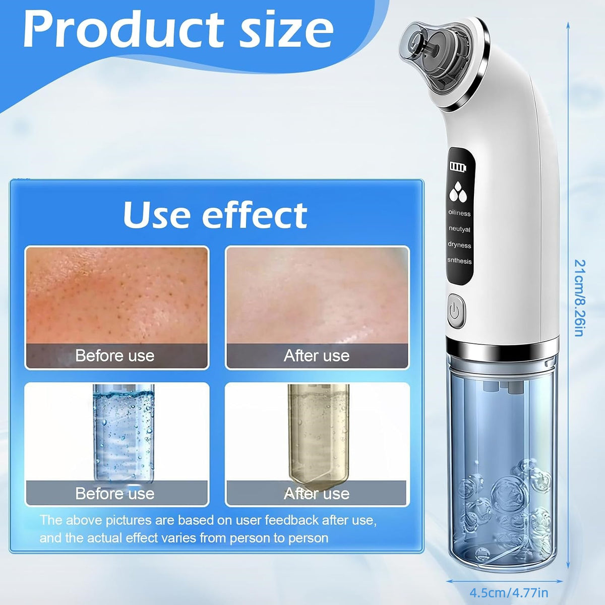 Blackhead Remover Pore Vacuum with 4 Suction Modes & 6 Tips