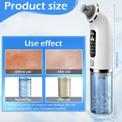 Blackhead Remover Pore Vacuum with 4 Suction Modes & 6 Tips