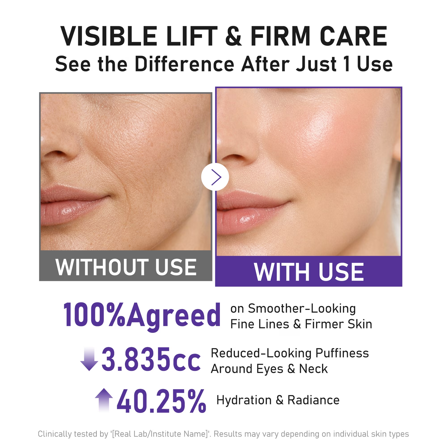 Neck Firming Cream With 6-Roller Massage – Peptide Hydration