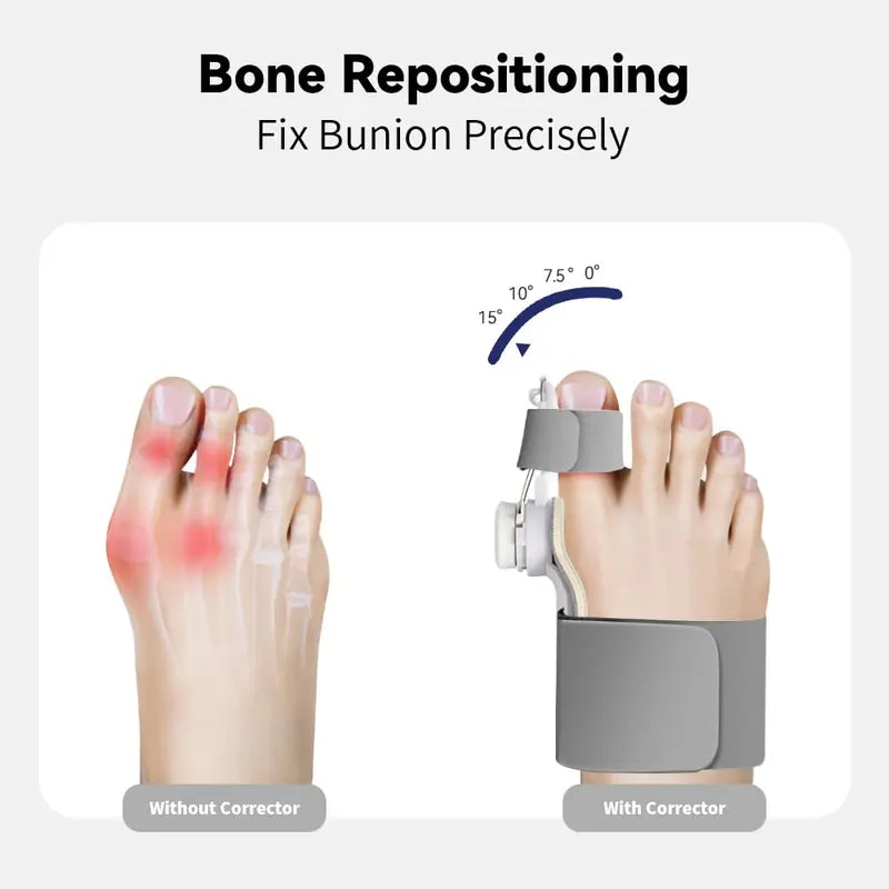 Unisex Orthopedic Bunion Splint