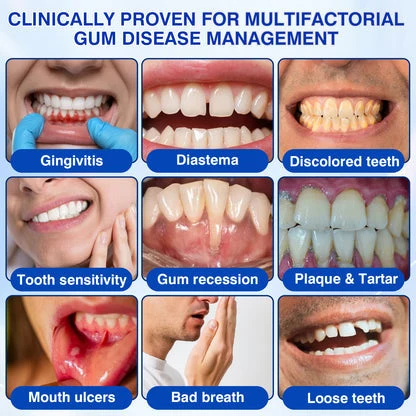 Periodontal Repair Gel