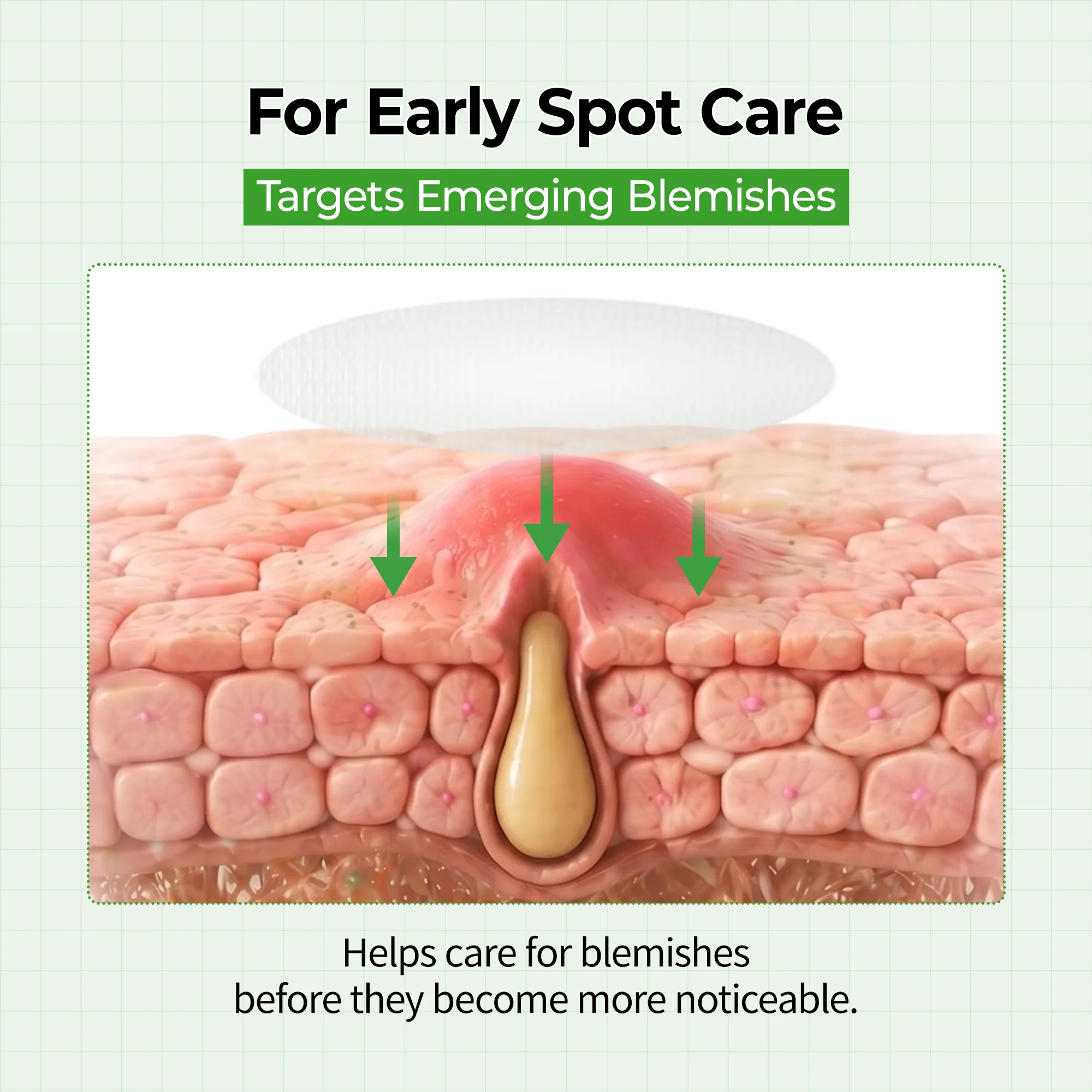 Zero-Fit Blemish & Dark Spot Patch Duo (144 Patches)