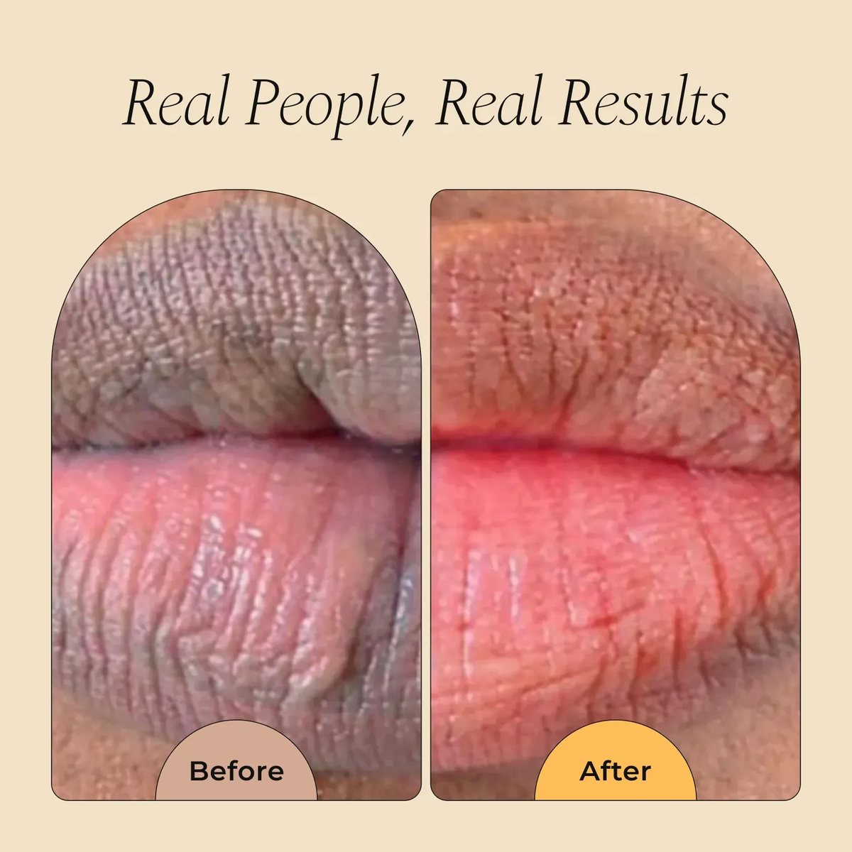 Turmeric & Lemon Lip Balm – Brightening & Nourishing for Dark or Smoker's Lips