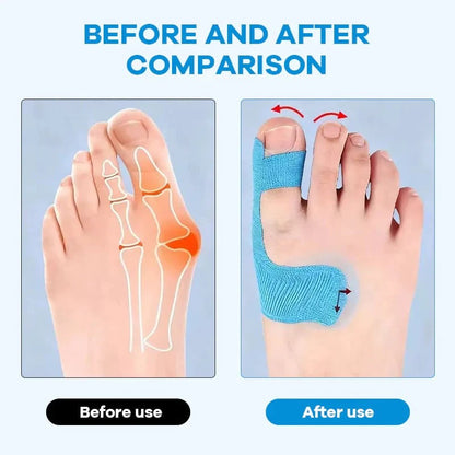 🔥Buy 1 Get 1 Free🔥Adjustable Bunion Relief Toe Corrector Wrap