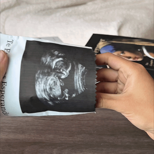 Baby’s First Ultrasound Projector Keepsake – Cherish the Very First Glimpse