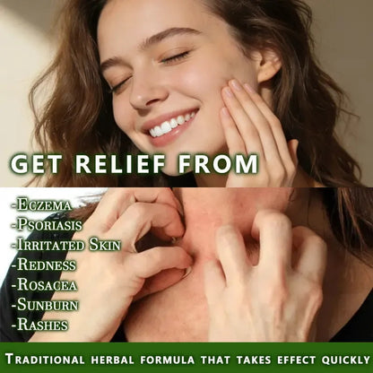 Natural Soothing & Relief Cream for Eczema – Honeysuckle & Peppermint, Gentle for All Ages