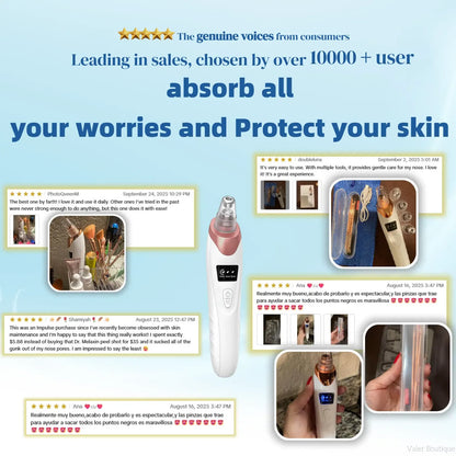 USB Rechargeable Blackhead Remover Pore Vacuum with 4 Suction Heads