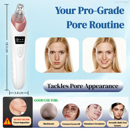 USB Rechargeable Blackhead Remover Pore Vacuum with 4 Suction Heads