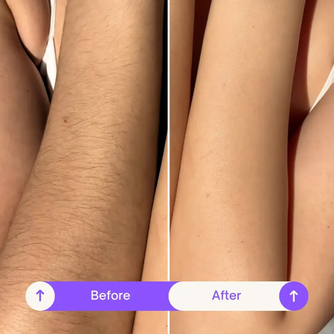 Body Hair Removal Cream for Women & Men