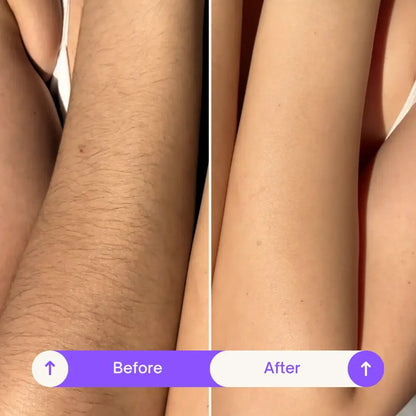 Body Hair Removal Cream for Women & Men