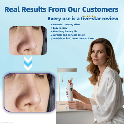 USB Rechargeable Blackhead Remover Pore Vacuum with 4 Suction Heads