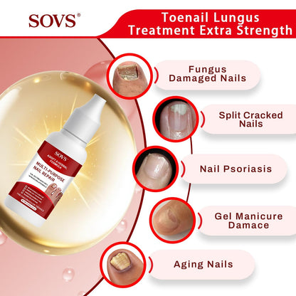 Multi-Purpose Nail Repair Treatment – Herbal Formula for Discolored, Thick & Damaged Nails