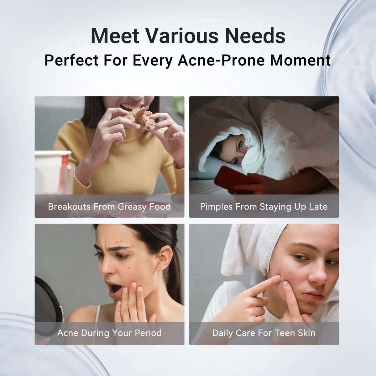 Drying Lotion Acne Spot Treatment – 1.8% Salicylic Acid