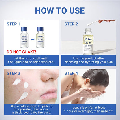 Drying Lotion Acne Spot Treatment – 1.8% Salicylic Acid