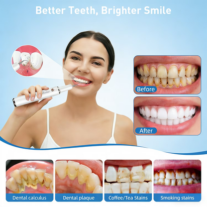 LED Dental Cleaning Kit – 5-Mode Rechargeable Plaque & Tartar Remover