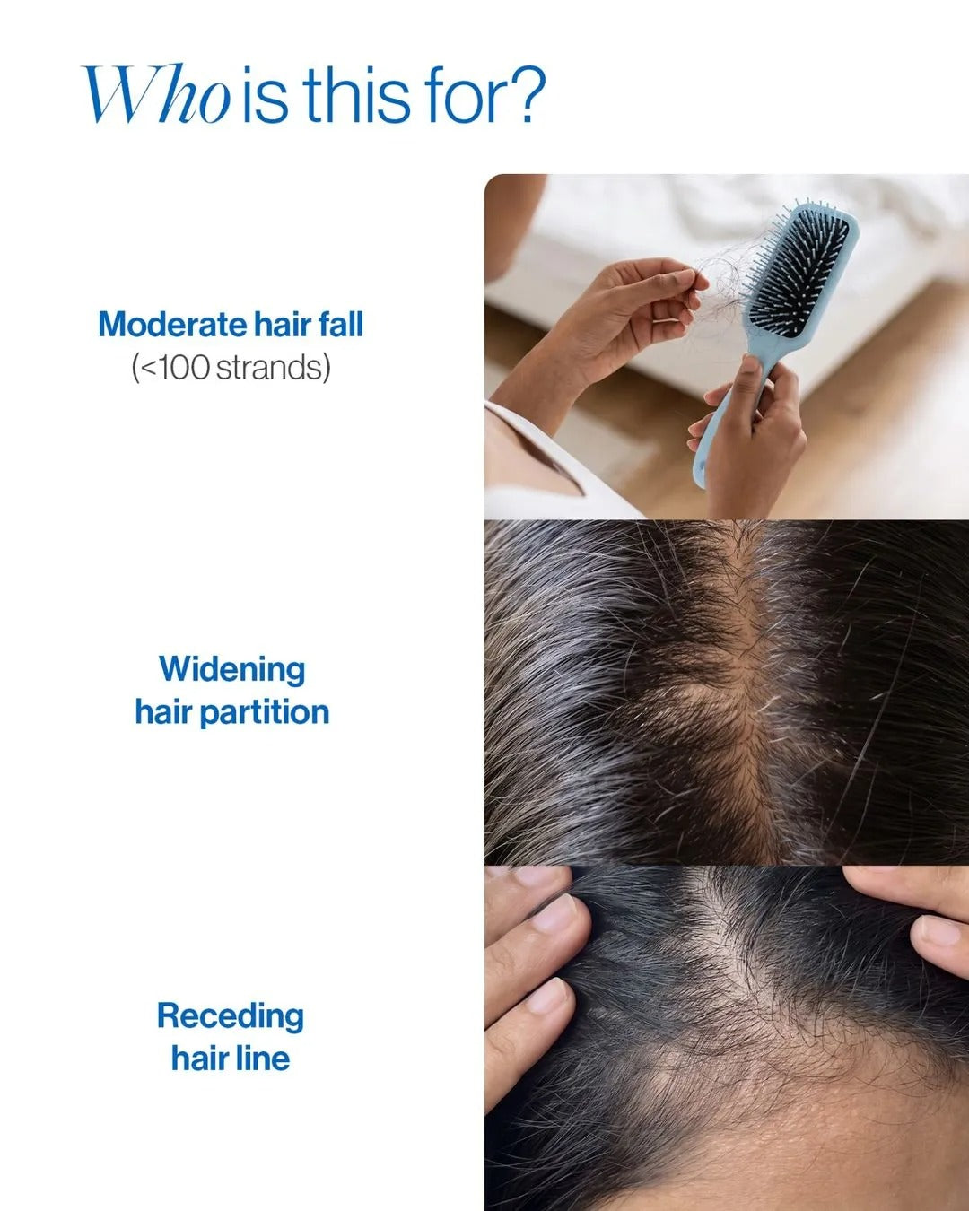 Rosemary Hair Growth Serum Roll-On – 3% Rosemary, 3% Redensyl & 2% Anagain
