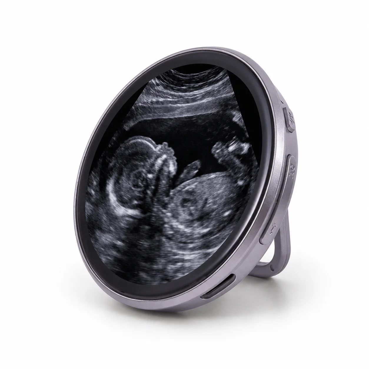 Baby’s First Ultrasound Projector Keepsake – Cherish the Very First Glimpse